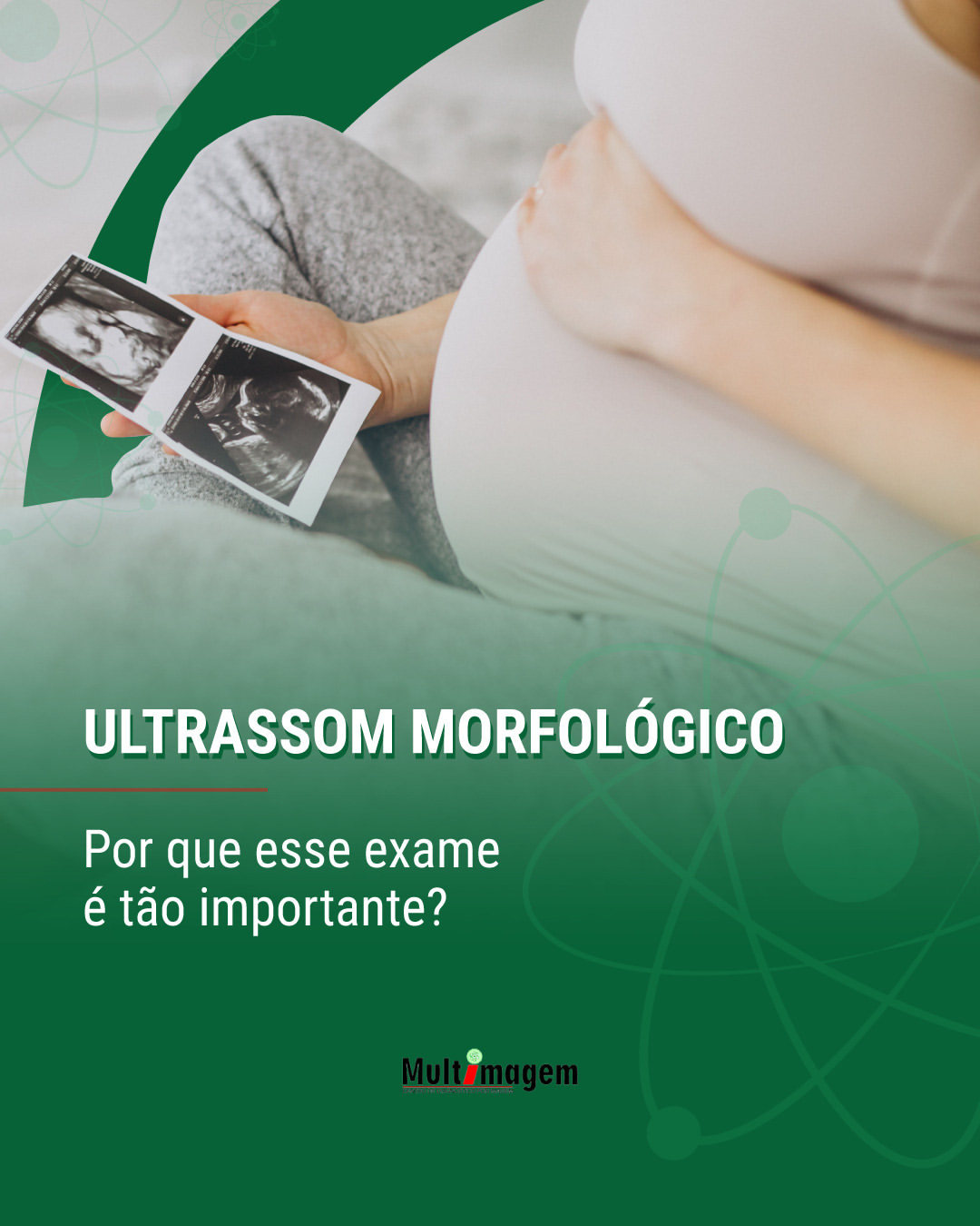 Ultrassom Morfol Gico Multimagem Centro De Diagn Sticos Por Imagem